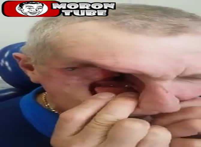 Video :This surgeon is pleased to show you his work!